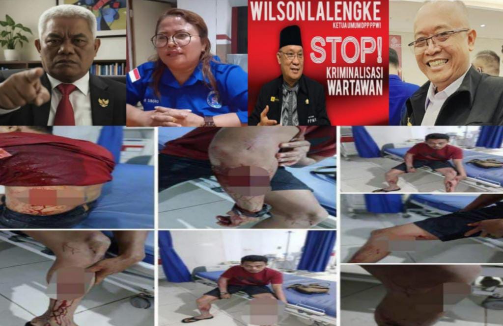 Persatuan Jurnalis, 15 Organisasi Pers Nasional Desak Penyelidikan Mendalam atas Kasus Penusukan Faisal